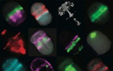 Fluorescent Staining of Acorn Worm Embryo