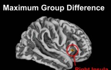 Cortical Surface