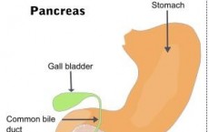 pancreatic cancer