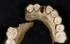 Neandertal Teeth