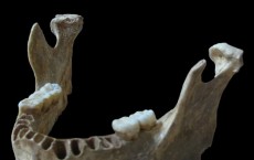 Human Jawbone