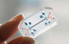 Organs-on-Chips