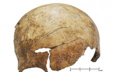 Skull