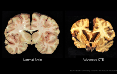 CTE Comparison