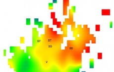 Age Map