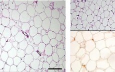 Fat Tissue Cells