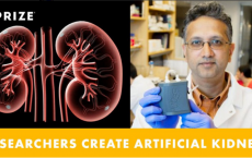 Implantable Artificial Kidney Built From Nanotechnology 