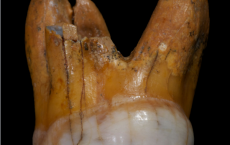 DNA Analysis Of Denisovan Molars Gives Clues On Ancient Human Relatives