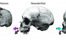 Facial growth comparison and bone structure  