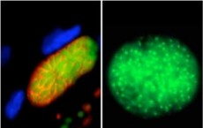 Toxoplasma Parasites