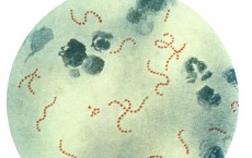 Streptococcus pyogenes Group A