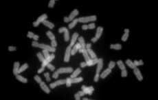 Human Chromosomes, Metaphase