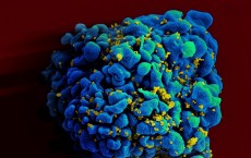 HIV infected T-Cell