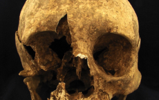 Skull From Skeleton Ancient Cemetery 