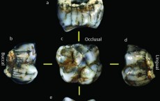 Hominin Molar