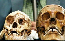 Indonesia's Hobbit-Sized Humans And Modern Human skeleton 