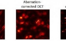 Computational Adaptive Optics