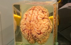 Human brain