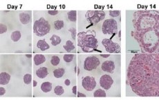 H1 Histone Embryoid Body Impaired Differentiation