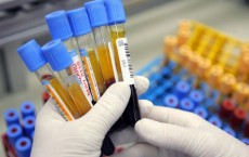 Israeli Laboratory Leads Western World In Blood Testing