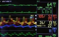 Vitals Monitoring