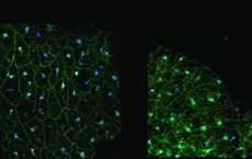 Fruit fly fat cells