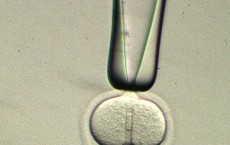 Nucleus Being Injected From A Micropipette