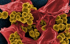 Micrograph of Methicillin-Resistant Staphylococcus aureus (MRSA)