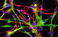 Stem Cells Open Doors To Greater Understanding Of Neurlogical Diseases 