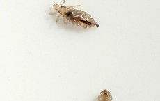 Common Head Lice