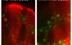 Gut Microbes Increase the absorption of Dietary Fats