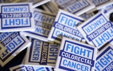 Colon Cancer Treatment