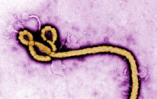 Ebola Virus