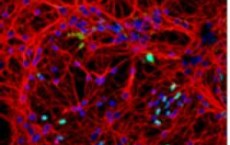 Neuronal cell cultures through a confocal microscope