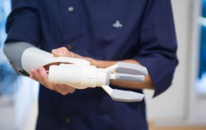 3D-Printed Prosthetic Arm Developed In Japan