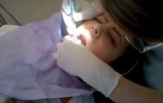 Tooth Filling