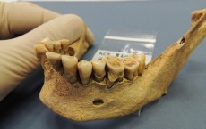 Ancient Teeth