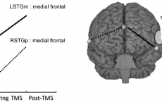 brain backup