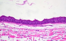 Epithelial Cells