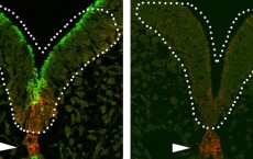 MDC Researchers Reveal Molecular Mechanism Underlying Severe Anomalies of the Forebrain