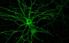 cultured neuron with projecting dendrites