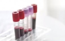 New Blood Test Determines Whether Cancer Treatment Is Working