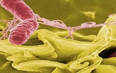 Salmonella Bacteria: What Is Salmonellosis?