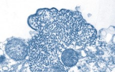 A single protein helps the body keep watch over the Epstein-Barr virus