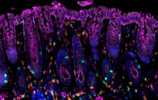 Cancer-Promoting Chronic Inflammation (IMAGE)