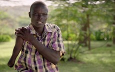 Snakebite Victim Sundai, from Kenya's Baringo County (IMAGE)