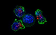 T Cells Surround a Cancer Cell (IMAGE)