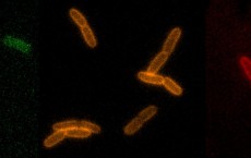 RfDAA Probes Light up Bacterial Cell Walls (IMAGE)