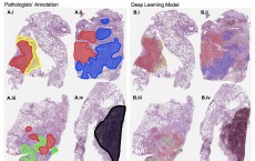 Visualization of Human and Machine Assessment of Lung Cancer Slides (IMAGE)