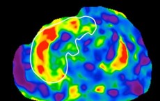 MRE Scan, Liver, UC San Diego School of Medicine (IMAGE)